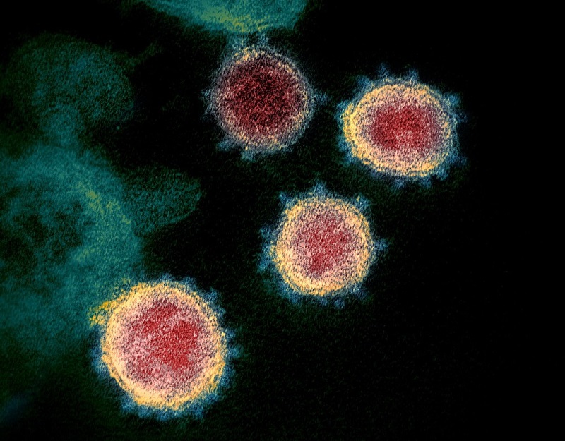 appearance of coronavirus covid-19 virus under a microscope.