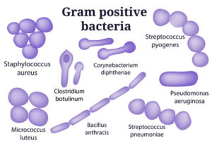 gram positive vs gram negative microscope